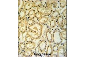 RT25 Antibody (C-term) (ABIN653808 and ABIN2843083) IHC analysis in formalin fixed and paraffin embedded human lung tissue followed by peroxidase conjugation of the secondary antibody and DAB staining. (MRPS25 antibody  (C-Term))