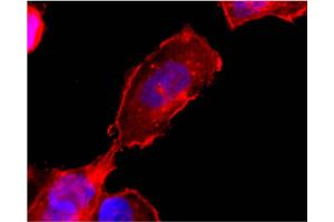Western blot analysis using EDG6 (S1P4) monoclonal antibody (X1533M) on cell lysate transfected with EDG6 (S1P4) protein  at 5 µg/ml. (S1PR4 antibody  (C-Term))