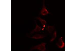 ABIN6274804 staining Hela cells by IF/ICC. (ACOT1 antibody  (Internal Region))