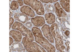 ABIN6266504 at 1/200 staining human kidney tissue sections by IHC-P. (JUP antibody  (C-Term))