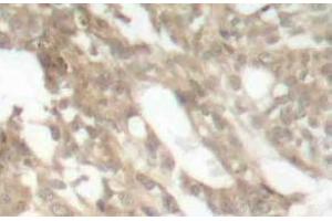 Immunohistochemistry (IHC) analyzes of PKC theta antibody in paraffin-embedded human skeletal muscle tissue. (PKC theta antibody)