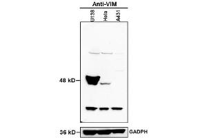 Western Blotting (WB) image for anti-Vimentin (VIM) (AA 371-466) antibody (ABIN672786)
