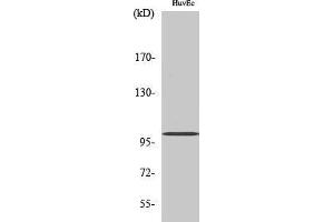 Western Blotting (WB) image for anti-Centrobin, Centrosomal BRCA2 Interacting Protein (CNTROB) (Internal Region) antibody (ABIN3183856) (CNTROB antibody  (Internal Region))