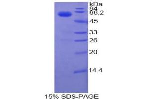 SDS-PAGE analysis of Cow Coagulation Factor VII Protein. (Factor VII Protein)