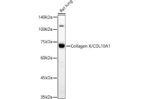 Western blot analysis of extracts of Rat lung, using Collagen X/COL10 antibody (8604) at 1:500 dilution. (COL10A1 antibody)
