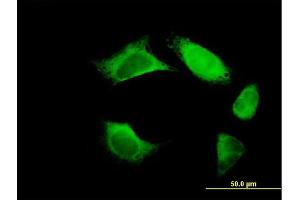 Immunofluorescence of purified MaxPab antibody to URP2 on HeLa cell. (FERMT3 antibody  (AA 1-663))