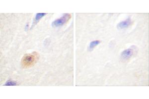 Peptide - +Immunohistochemical analysis of paraffin-embedded human brain tissue using CSantibody. (Exportin 2 antibody)