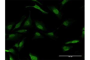 Immunofluorescence of purified MaxPab antibody to PPM1A on HeLa cell. (PPM1A antibody  (AA 1-382))