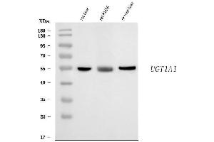 Western blot analysis of Ugt1a1 using anti-Ugt1a1 antibody (ABIN7602059).