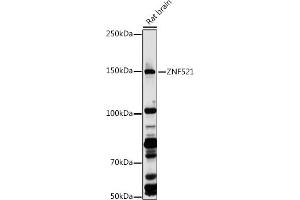 Western blot analysis of extracts of Rat brain, using ZNF521 antibody (ABIN7271496) at 1:1000 dilution. (ZNF521 antibody  (AA 210-420))