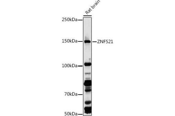 ZNF521 抗体  (AA 210-420)