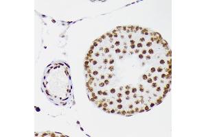 Immunohistochemistry of paraffin-embedded rat testis using DNA Ligase I Rabbit mAb (ABIN7268251) at dilution of 1:100 (40x lens). (LIG1 antibody)