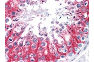 Immunohistochemistry (IHC) image for anti-Stromal Interaction Molecule 1 (STIM1) (AA 24-686) antibody (ABIN614666) (STIM1 antibody  (AA 24-686))
