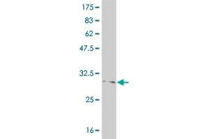 Western Blot detection against Immunogen (37. (FOXL1 antibody  (AA 132-240))