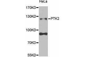 Western blot analysis of extracts of HeLa cells, using PTK2 antibody (ABIN5971141) at 1/1000 dilution. (FAK antibody)