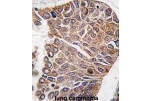 Immunohistochemistry (IHC) image for anti-V-Akt Murine Thymoma Viral Oncogene Homolog 2 (AKT2) antibody (ABIN3002942)