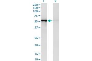 Western Blot analysis of ZNF207 expression in transfected 293T cell line by ZNF207 monoclonal antibody (M03), clone 6H8. (ZNF207 antibody  (AA 1-110))