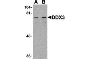 Western Blotting (WB) image for anti-DEAD (Asp-Glu-Ala-Asp) Box Polypeptide 3, X-Linked (DDX3X) (Middle Region) antibody (ABIN1030917)