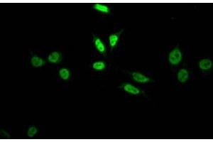 Immunofluorescence staining of HepG2 Cells with ABIN7127811 at 1:50, counter-stained with DAPI. (Recombinant SKP2 antibody)