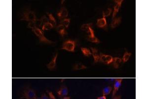 Immunofluorescence analysis of C6 cells using ARL13B Polyclonal Antibody at dilution of 1:100. (ARL13B antibody)
