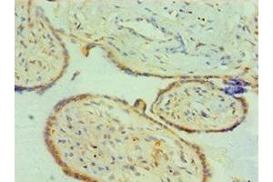 Immunohistochemistry of paraffin-embedded human placenta tissue using ABIN7147014 at dilution of 1:100 (Cathepsin K antibody  (AA 115-329))