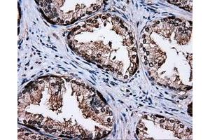 Immunohistochemical staining of paraffin-embedded liver tissue using anti-MCL1 mouse monoclonal antibody. (MCL-1 antibody)