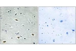 Immunohistochemistry analysis of paraffin-embedded human brain tissue, using MTG16 Antibody. (CBFA2T3 antibody  (AA 261-310))