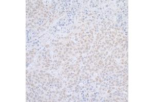 Immunohistochemistry (IHC) image for anti-ElaC Homolog 2 (ELAC2) (AA 776-826) antibody (ABIN7455054) (ELAC2 antibody  (AA 776-826))