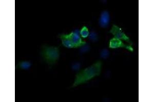 Image no. 2 for anti-Mitogen-Activated Protein Kinase Kinase 1 (MAP2K1) antibody (ABIN1499374) (MEK1 antibody)
