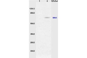 Formalin-fixed and paraffin embedded rat tongue tissue labeled with Anti-phospho-Nrf2 (Ser40) Polyclonal Antibody (ABIN676673), Unconjugated 1:200 followed by conjugation to the secondary antibody and DAB staining (NRF2 antibody  (pSer40))