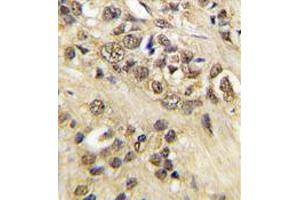 Image no. 2 for anti-Myc Proto-Oncogene protein (MYC) antibody (ABIN357365) (c-MYC antibody)
