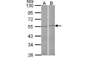 FBXL2 Antikörper  (N-Term)