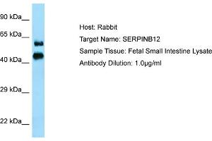 Host: RabbitTarget Name: SERPINB12Antibody Dilution: 1. (SERPINB12 antibody  (N-Term))