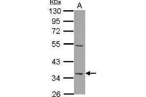 WB Image Decorin antibody detects DCN protein by Western blot analysis.