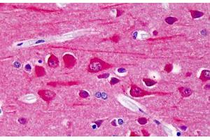 Human Brain, Cortex: Formalin-Fixed, Paraffin-Embedded (FFPE) (CAMK2B antibody  (pThr286))