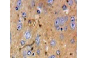 Used in DAB staining on fromalin fixed paraffin-embedded Brain tissue (HSPA4 antibody  (AA 258-511))