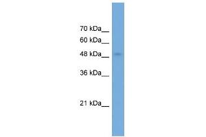 WB Suggested Anti-NPTX2 Antibody Titration: 0. (NPTX2 antibody  (Middle Region))