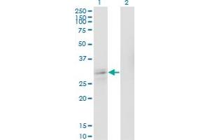 Western Blot analysis of ASCL1 expression in transfected 293T cell line by ASCL1 polyclonal antibody (A01). (ASCL1 antibody  (AA 137-236))