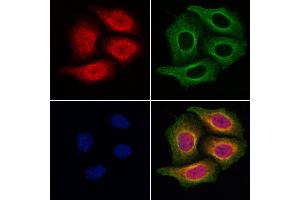 ABIN6257303 and ABIN6275012 staining Hela cells by IF/ICC.