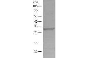 Western Blotting (WB) image for Lactate Dehydrogenase A (LDHA) (AA 283-332) protein (His-IF2DI Tag) (ABIN7282005) (Lactate Dehydrogenase A Protein (LDHA) (AA 283-332) (His-IF2DI Tag))