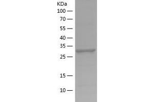 Lactate Dehydrogenase A Protein (LDHA) (AA 283-332) (His-IF2DI Tag)