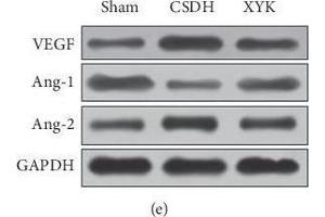 In the XYK group, HIF-1α and VEGF decreased, E3 ubiquitin-protein ligase parkin and 26S proteasome protein increased, and the Ang-1/Ang-2 ratio increased in the hematoma. (VEGFA antibody  (AA 27-190))