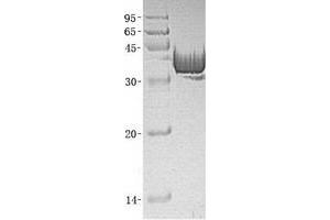Western Blotting (WB) image for Aldolase A, Fructose-Bisphosphate (ALDOA) (Transcript Variant 1) protein (His tag) (ABIN2714558)