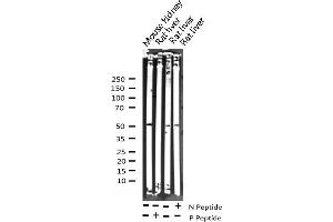 Western blot analysis of Phospho-HNF4 alpha (Ser313) expression in various lysates