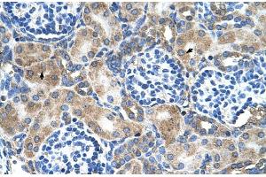 Human kidney (SOD1 antibody  (N-Term))