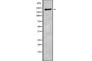 Western blot analysis of PLXNA2 using Jurkat whole cell lysates (Plexin A2 antibody  (Internal Region))