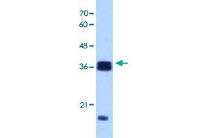 Western Blot analysis of Raji cell lysate with HNRNPH3 polyclonal antibody  at 1 ug/mL working concentration. (HNRNPH3 antibody  (N-Term))