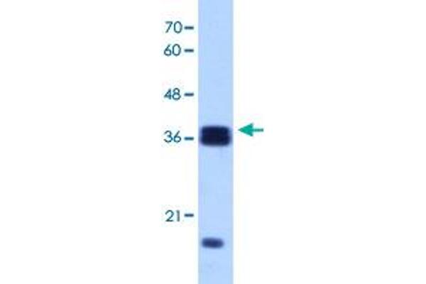 HNRNPH3 antibody  (N-Term)
