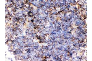 IHC testing of FFPE mouse lymph node with CD14 antibody. (CD14 antibody  (AA 65-327))