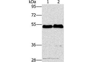 Western blot analysis of Mouse brain and liver tissue, using SPHK2 Polyclonal Antibody at dilution of 1:200 (SPHK2 antibody)